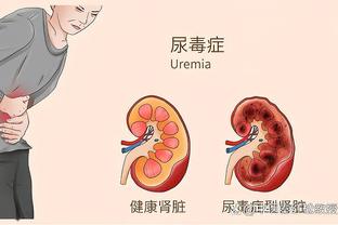 蒙蒂：今日格莱姆斯因左膝扭伤缺阵 他的伤势不严重